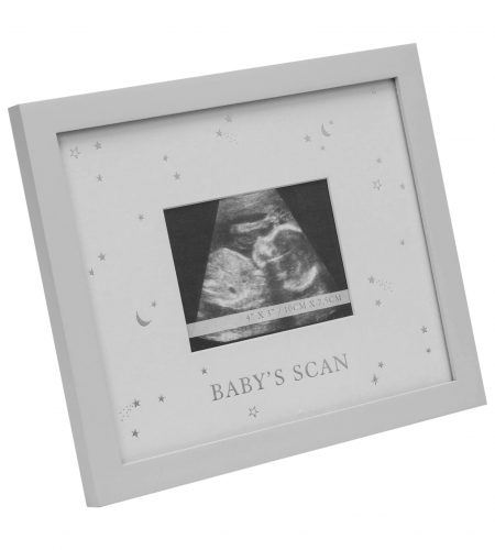 Baby Photo Frame - Baby's Scan